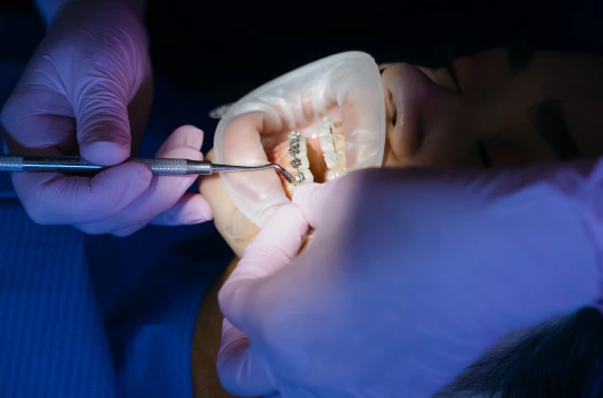 Orthodontic Excellence