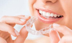 Invisalign - Invisible Braces treatment