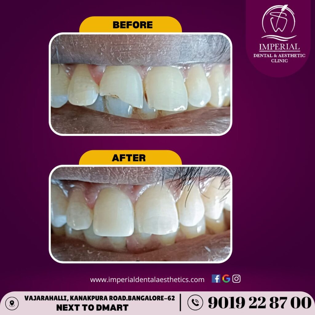 Smile Correction