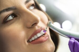 Dental scaling treatment in Bangalore
