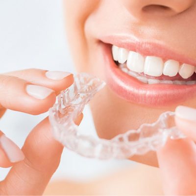 Invisible-Clear-Braces